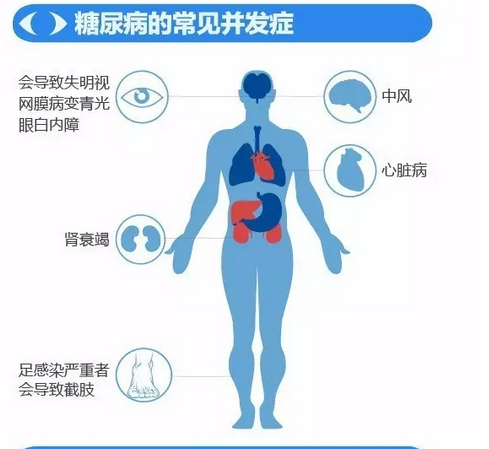 你造嗎？糖尿病晚期眼睛會(huì)致盲！