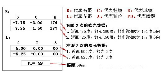 眼科醫(yī)生教你如何一分鐘看懂驗光單！