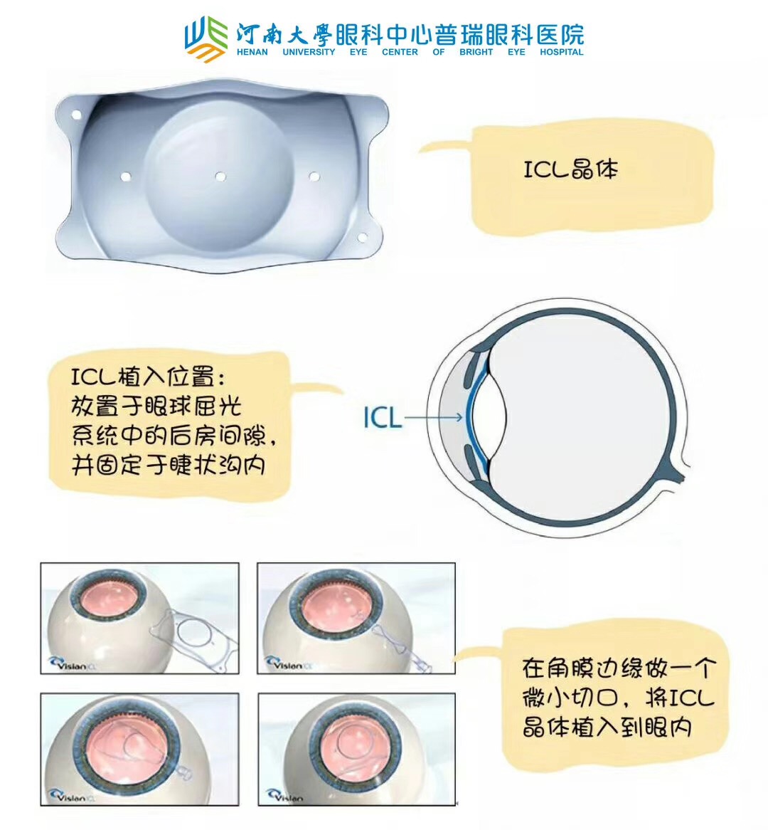 近視度數太高，還能做手術嗎？